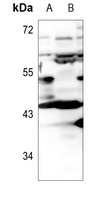 Apolipoprotein L1 Antibody