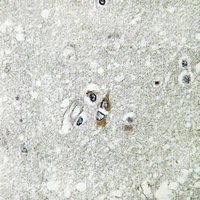Apolipoprotein L1 Antibody