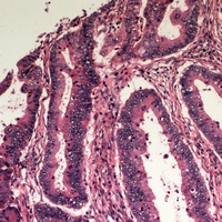 Apolipoprotein L3 antibody