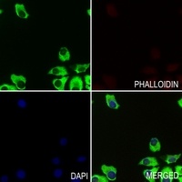 Anti-Apolipoprotein L3 Antibody