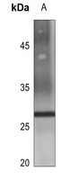 Aquaporin 2 Rabbit Polyclonal Antibody