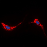 Aquaporin 2 antibody