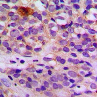 Anti-ARRDC4 Antibody