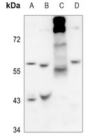 Arylsulfatase B Antibody