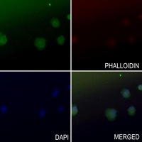 Arylsulfatase B Antibody