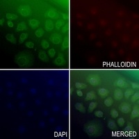 Anti-ATP6V0A2 Antibody
