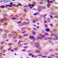 Anti-Ataxin 7L1 Antibody
