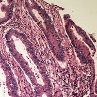 Anti-B4GALT2 Antibody