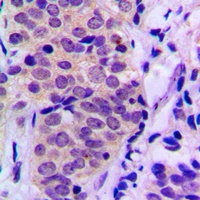 Anti-BAD (Phospho-S155) Antibody