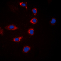 BAD (phospho-S155) antibody