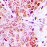 Anti-ZNF134 Antibody