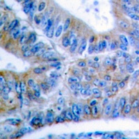 Anti-BCLX (Phospho-S62) Antibody