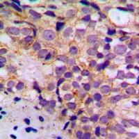 Anti-BIM (Phospho-S69) Antibody