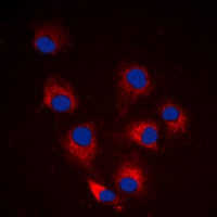 Anti-BIM (Phospho-S69) Antibody