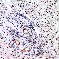 BCL6 Antibody