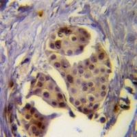 Anti-CD292 Antibody