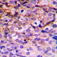 Anti-BMX Antibody