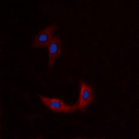Anti-BMX Antibody