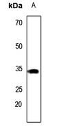 Carbonic Anhydrase 8 Antibody