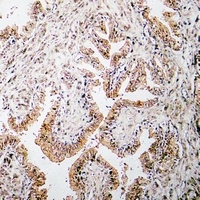 Alpha-type CGRP antibody