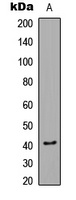 CaMK1 alpha (Phospho-T177) Antibody