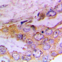 CaMK1 alpha (Phospho-T177) Antibody