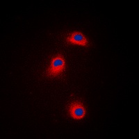 CaMK1 alpha (phospho-T177) antibody
