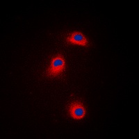 CaMK1 alpha (Phospho-T177) Antibody