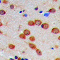 Anti-CaMK2 alpha/delta (Phospho-T286) Antibody