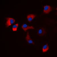 Anti-CaMK2 alpha/delta (Phospho-T286) Antibody