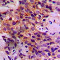 Caspase 2 Rabbit Polyclonal Antibody