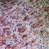 CCL26 antibody