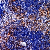 Anti-CCR4 Antibody