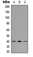 CCR11 Rabbit Polyclonal Antibody