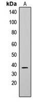CD79b Antibody