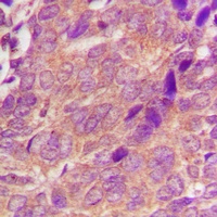 Anti-CDC25A Antibody