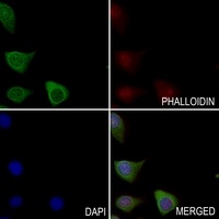 CDCA2 antibody