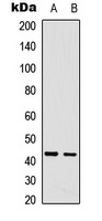CDCA7 Antibody