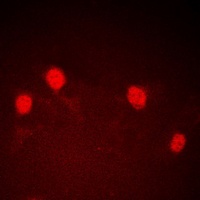 CDCA7 antibody