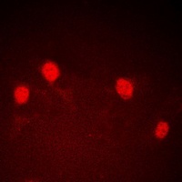 Anti-CDCA7 Antibody