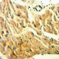 Anti-CDK2AP1 Antibody