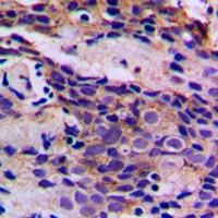 Anti-CDK5 (Phospho-Y15) Antibody