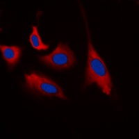 Anti-CDK5 (Phospho-Y15) Antibody
