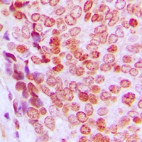 Anti-p21 (Phospho-T145) Antibody
