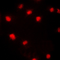 Anti-p21 (Phospho-T145) Antibody
