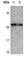 p27 Kip1 (Phospho-T187) Antibody