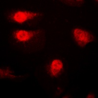 p27 Kip1 (Phospho-T187) Antibody