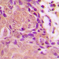 Anti-p16 INK4a (Phospho-S326) Antibody
