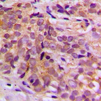 Anti-CEP170 Antibody