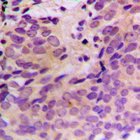 Anti-CERKL Antibody